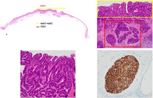 Details are in the caption following the image Details are in the caption following the image