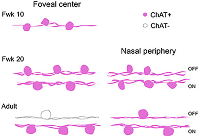 Development of ON and OFF cholinergic amacrine cells in the human fetal retina