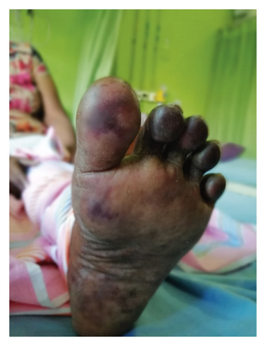 Details are in the caption following the image