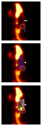Details are in the caption following the image