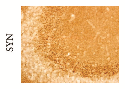 Details are in the caption following the image