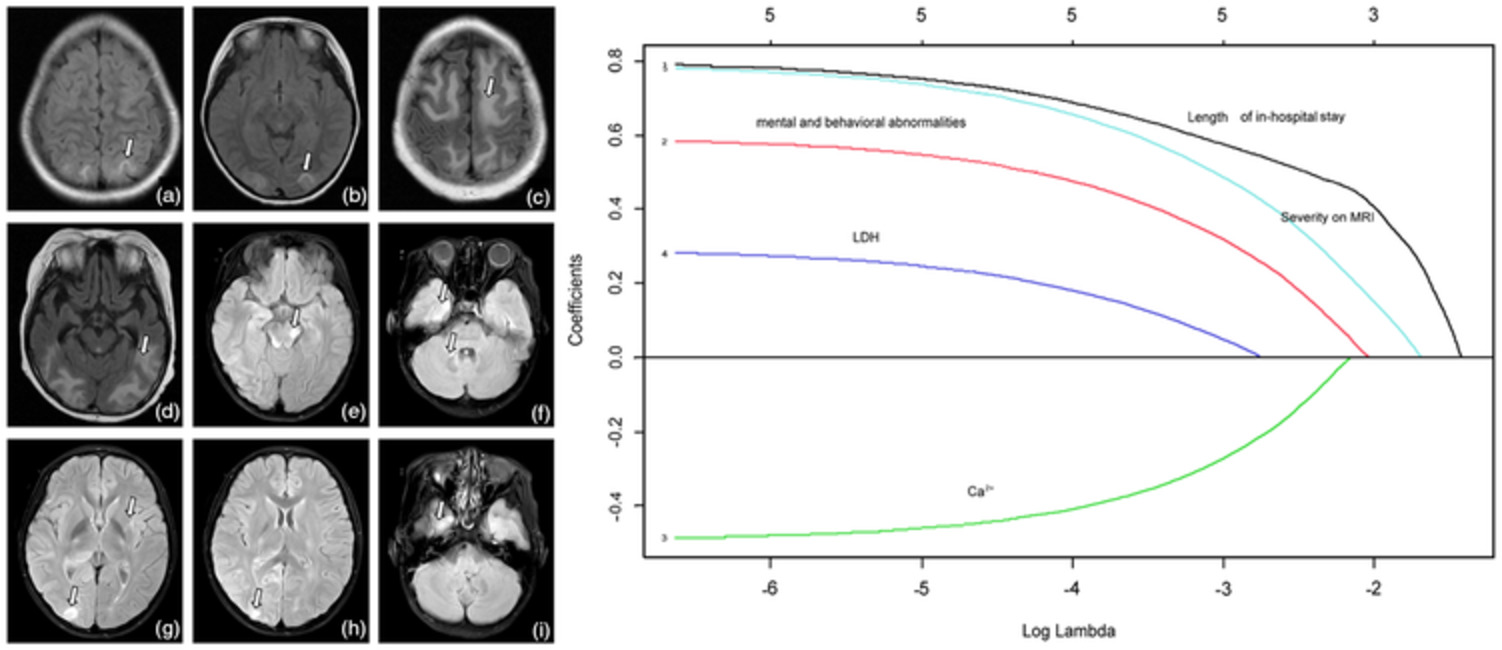 Clinical features and prognostic analysis of posterior reversible encephalopathy syndrome in children