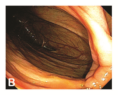 Details are in the caption following the image Details are in the caption following the image
