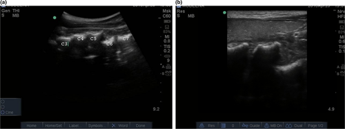 Details are in the caption following the image Details are in the caption following the image
