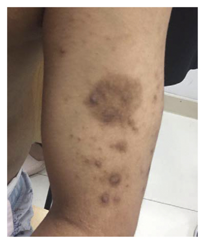 Details are in the caption following the image Details are in the caption following the image