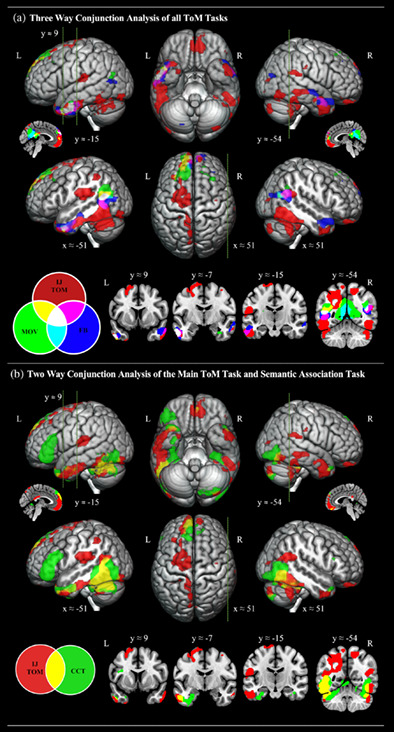 The role of the ventrolateral anterior temporal lobes in social cognition