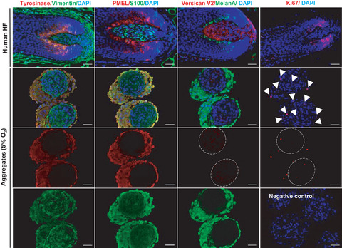 Dermal papilla cells and melanocytes response to physiological oxygen levels depends on their interactions