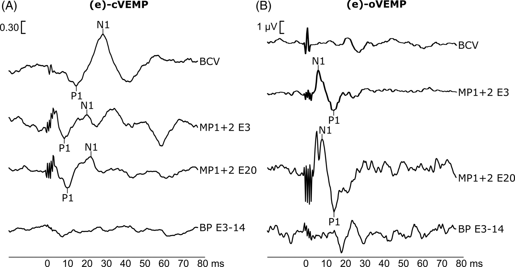 Stimulation conditions leading to electrical vestibular co-stimulation in cochlear implant users