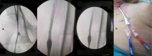 Details are in the caption following the image Details are in the caption following the image