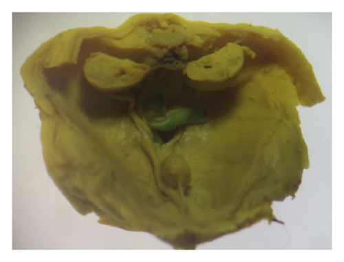 Details are in the caption following the image Details are in the caption following the image