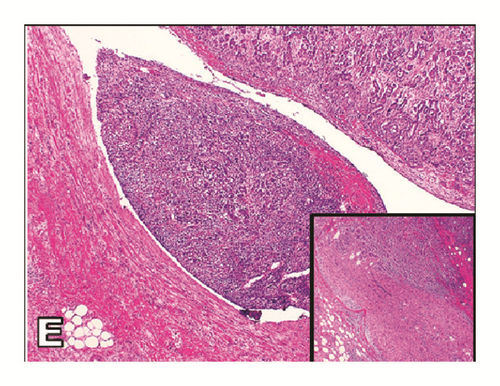 Details are in the caption following the image