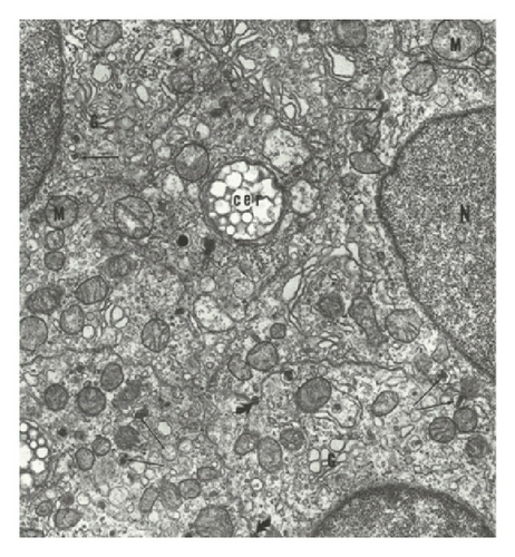 Details are in the caption following the image