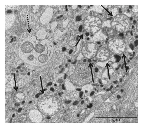 Details are in the caption following the image Details are in the caption following the image