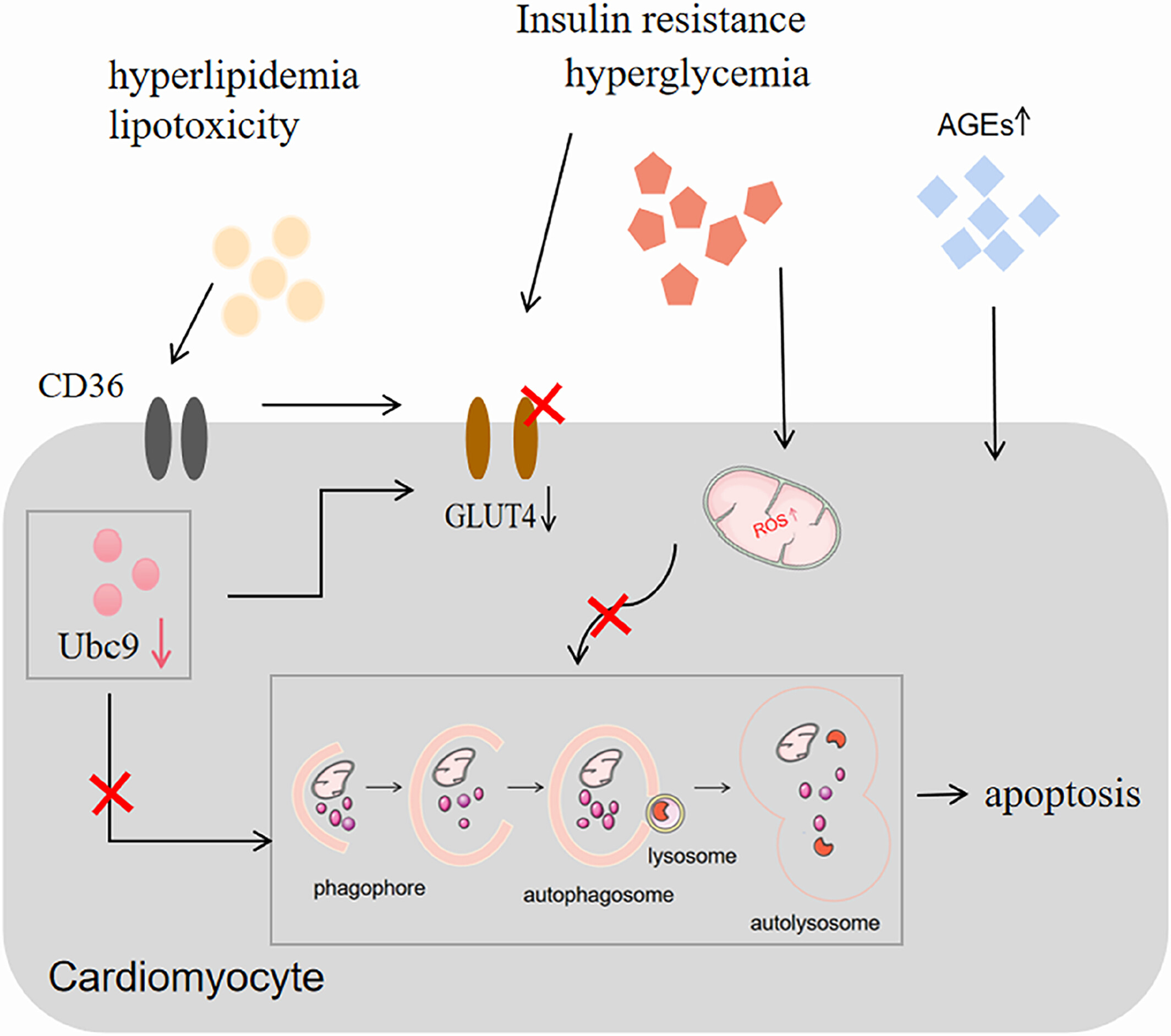 Ubiquitin-conjugating enzyme E2 for regulating autophagy in diabetic cardiomyopathy: A mini-review