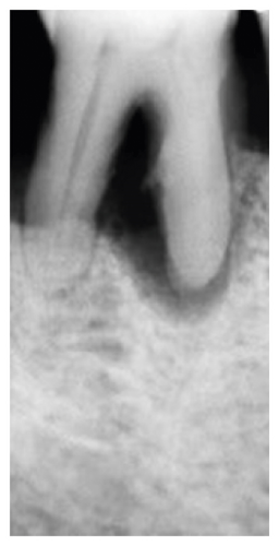Details are in the caption following the image