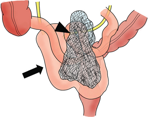 Details are in the caption following the image Details are in the caption following the image