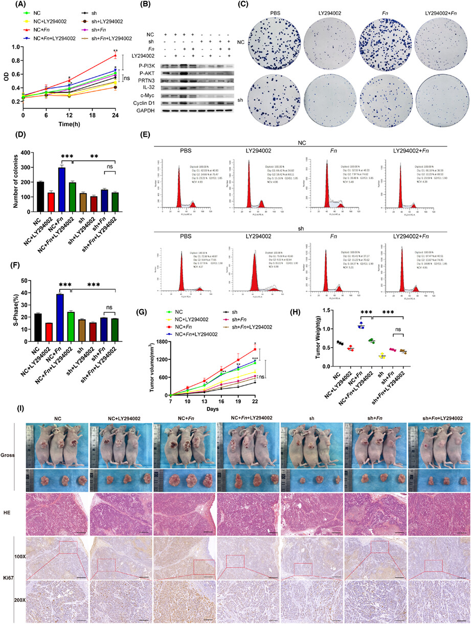 Fusobacterium nucleatum promotes the early occurrence of esophageal cancer through upregulation of IL-32/PRTN3 expression