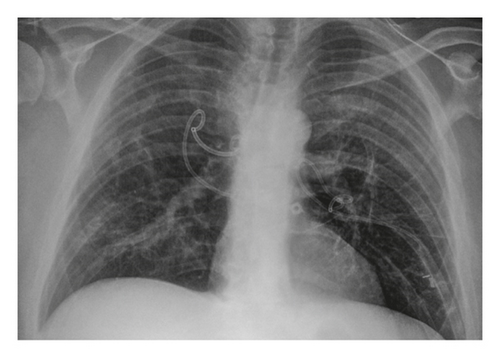 Details are in the caption following the image