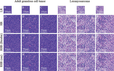 Development of pathological reconstructed high-resolution images using artificial intelligence based on whole slide image