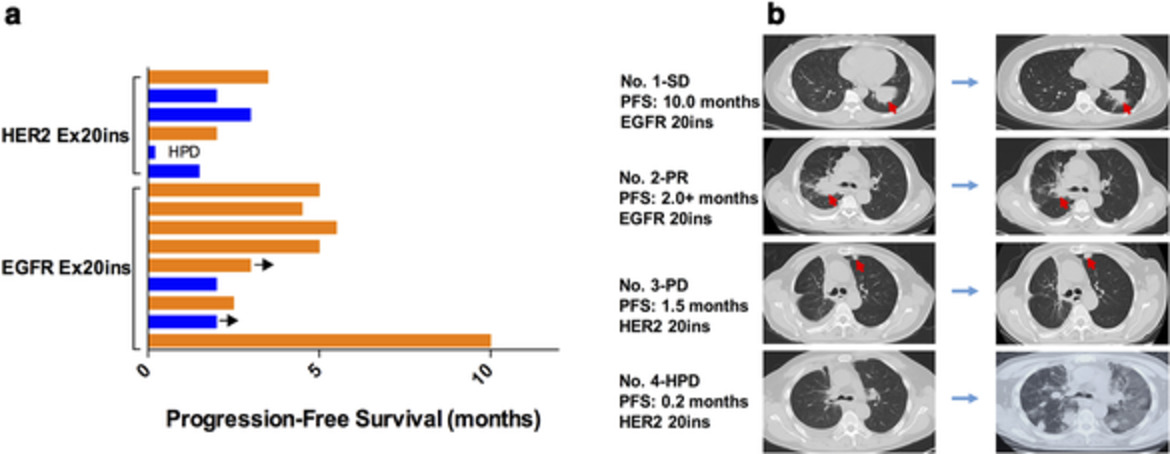 Immune microenvironment features and efficacy of PD-1/PD-L1 blockade in non-small cell lung cancer patients with EGFR or HER2 exon 20 insertions