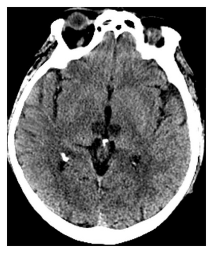 Details are in the caption following the image