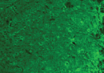 Details are in the caption following the image