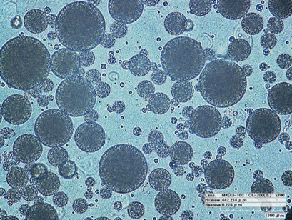 W/O/W Multiple Emulsions as the Functional Component of Dairy Products