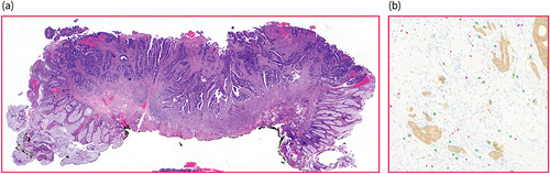 Details are in the caption following the image Details are in the caption following the image