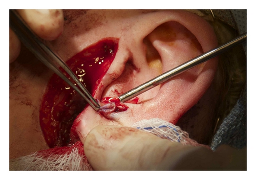 Details are in the caption following the image Details are in the caption following the image