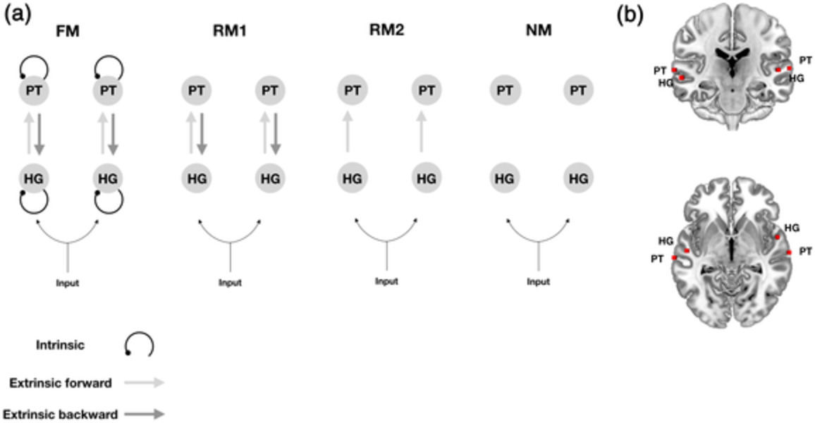 Perceptual learning of tone patterns changes the effective connectivity between Heschl's gyrus and planum temporale