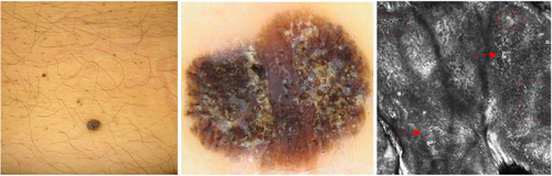 Details are in the caption following the image Details are in the caption following the image
