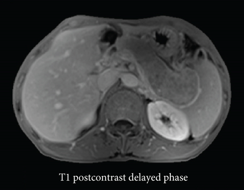 Details are in the caption following the image