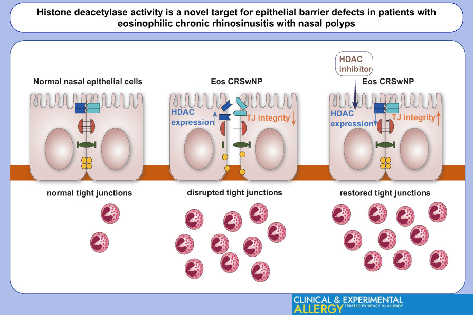 Histone deacetylase activity is a novel target for epithelial barrier defects in patients with eosinophilic chronic rhinosinusitis with nasal polyps