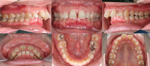 Details are in the caption following the image Details are in the caption following the image