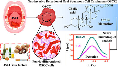 Hybrid Poly(Methacrylic Acid-Co-Acrylamide)-Polythiophene Nanofibers for Salivary Diagnosis of Oral Squamous Cell Carcinoma