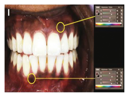 Details are in the caption following the image Details are in the caption following the image