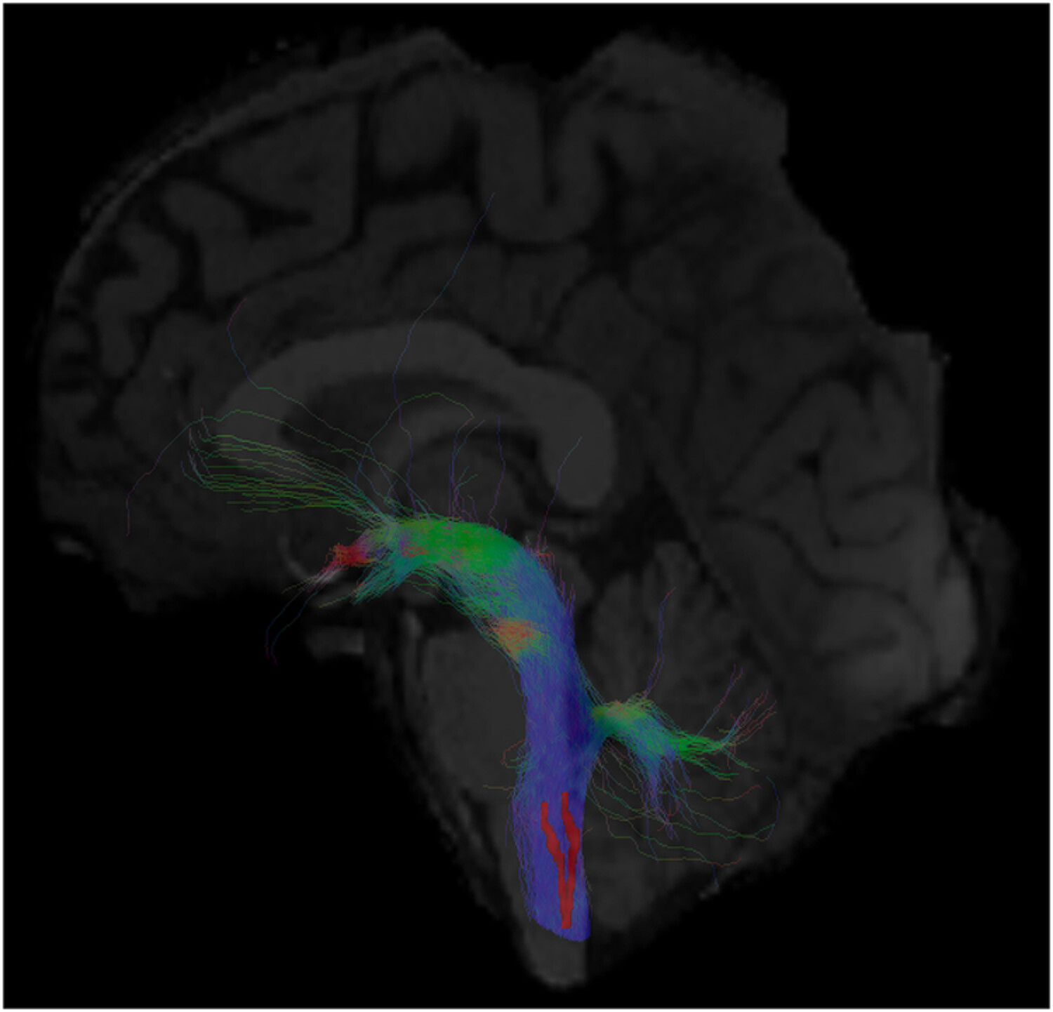 The solitary nucleus connectivity to key autonomic regions in humans