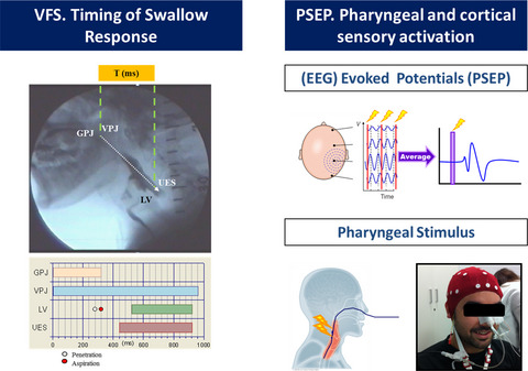 A randomized clinical trial on the acute therapeutic effect of TRPA1 and TRPM8 agonists in patients with oropharyngeal dysphagia