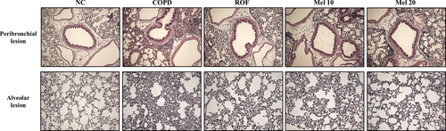 Details are in the caption following the image Details are in the caption following the image