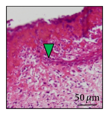 Details are in the caption following the image