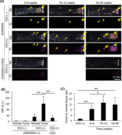 Fluorescence tumor imaging by i.v. administered indocyanine green in a mouse model of colitis-associated colon cancer