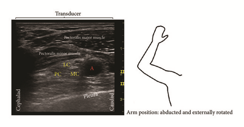 Details are in the caption following the image Details are in the caption following the image