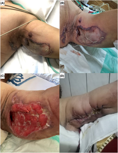 Details are in the caption following the image Details are in the caption following the image
