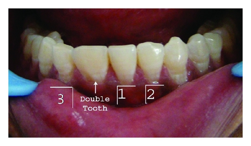 Details are in the caption following the image