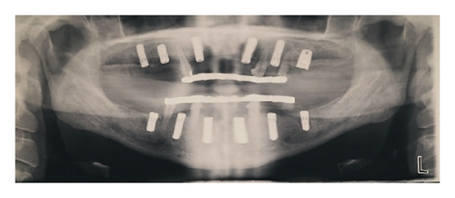 Details are in the caption following the image Details are in the caption following the image