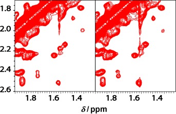 Accelerated NMR Spectroscopy by Using Compressed Sensing