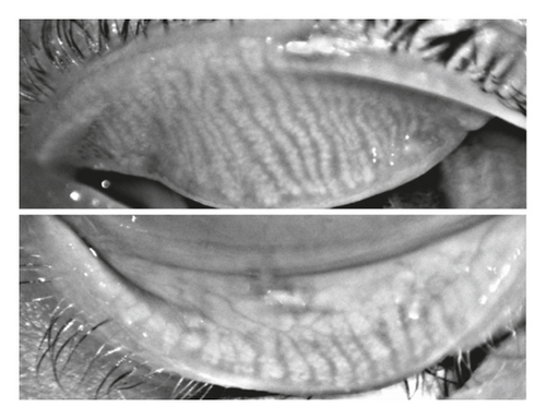 Details are in the caption following the image Details are in the caption following the image