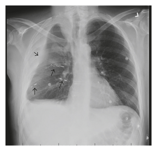 Details are in the caption following the image
