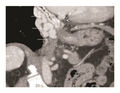 Details are in the caption following the image