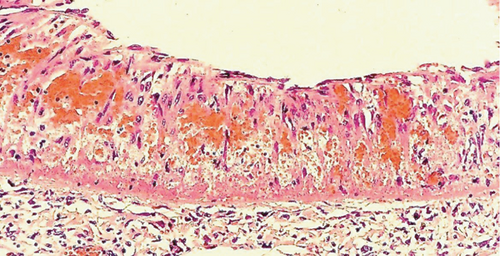 Details are in the caption following the image